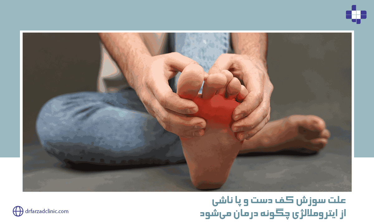 علت سوزش کف دست و پا